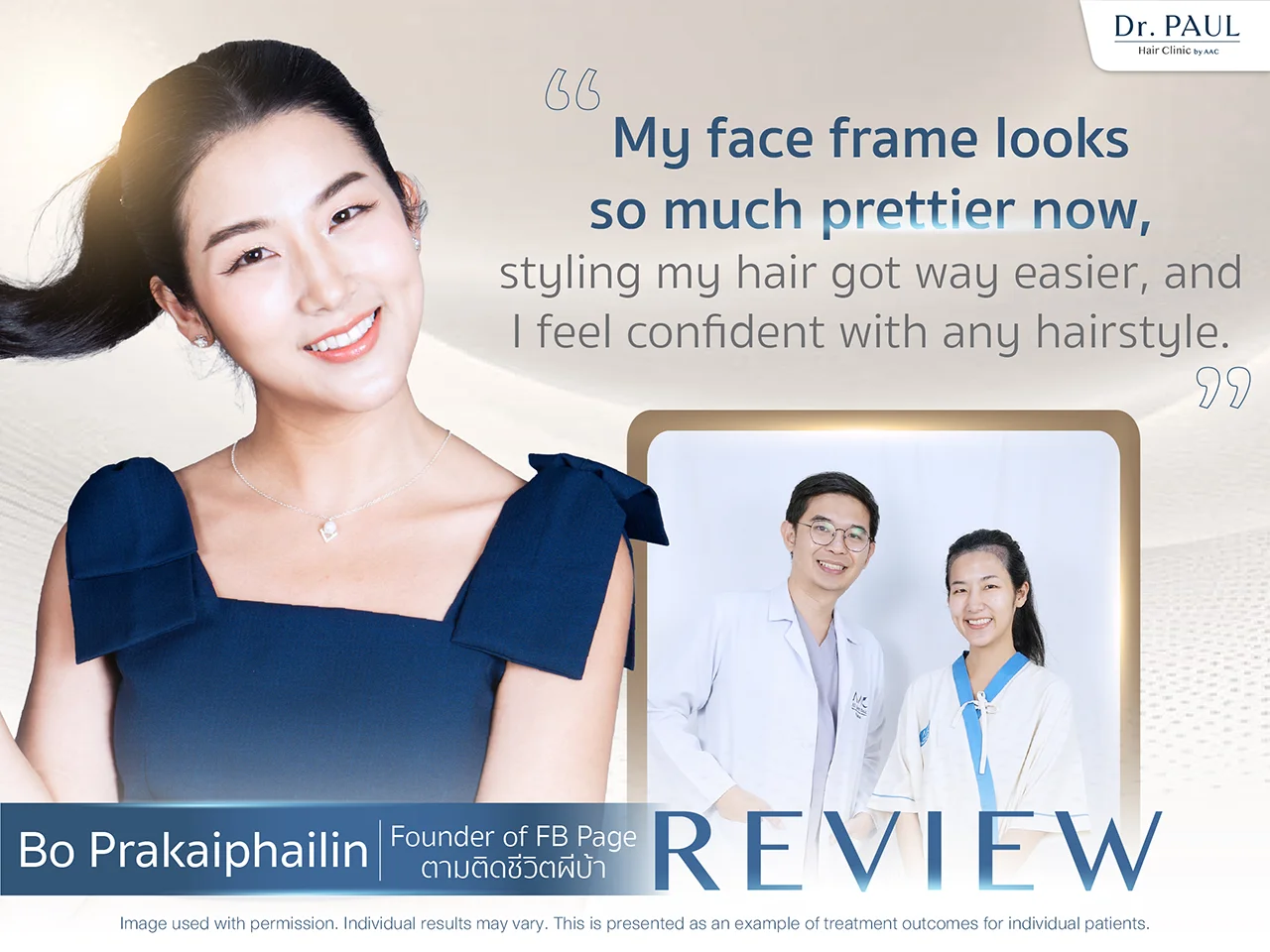 Thai Female Celebs Hair Transplant Review — Bo Prakaiphailin