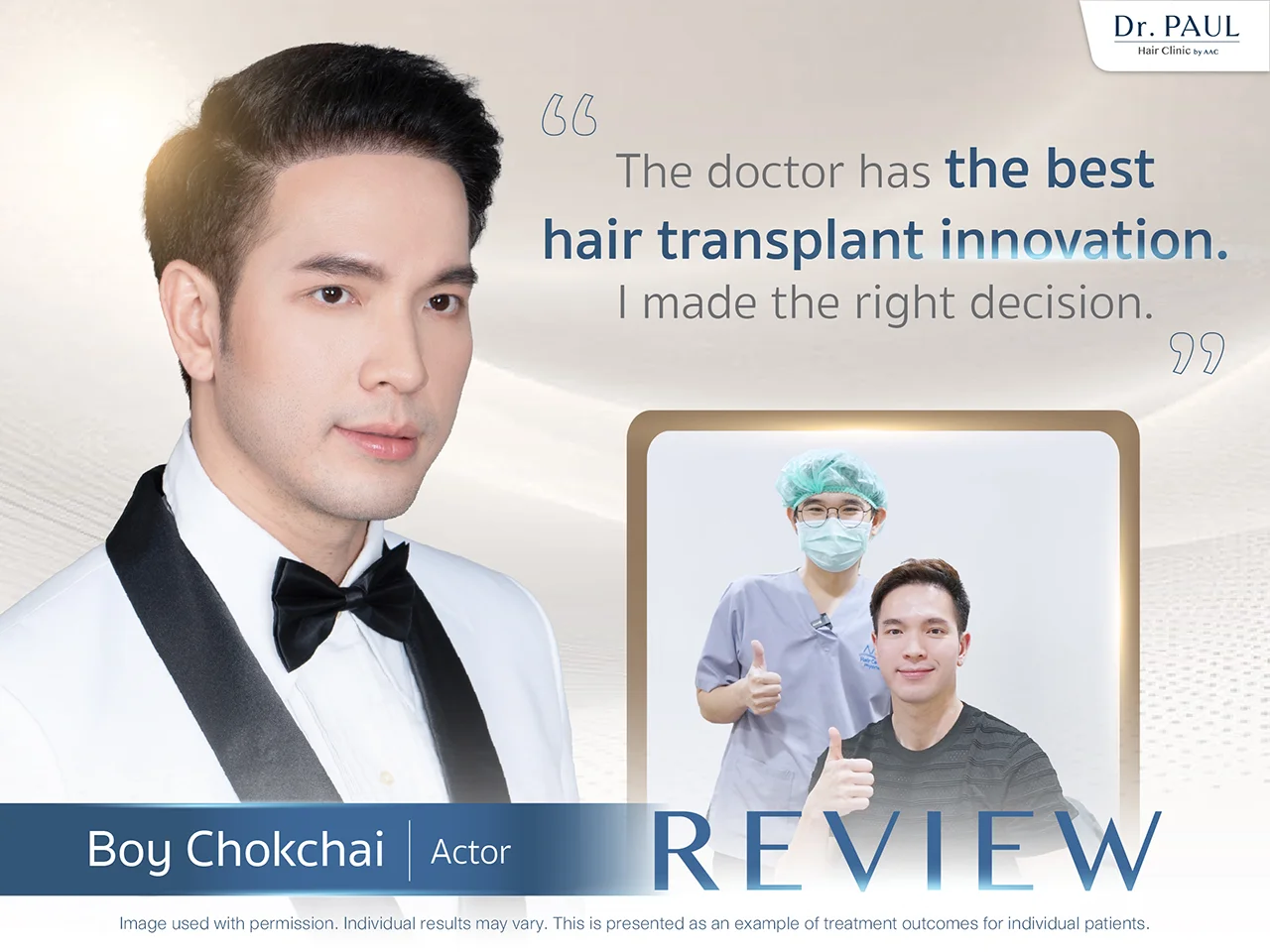 Thai Male Celebs Hair Transplant Review — Boy Chokchai