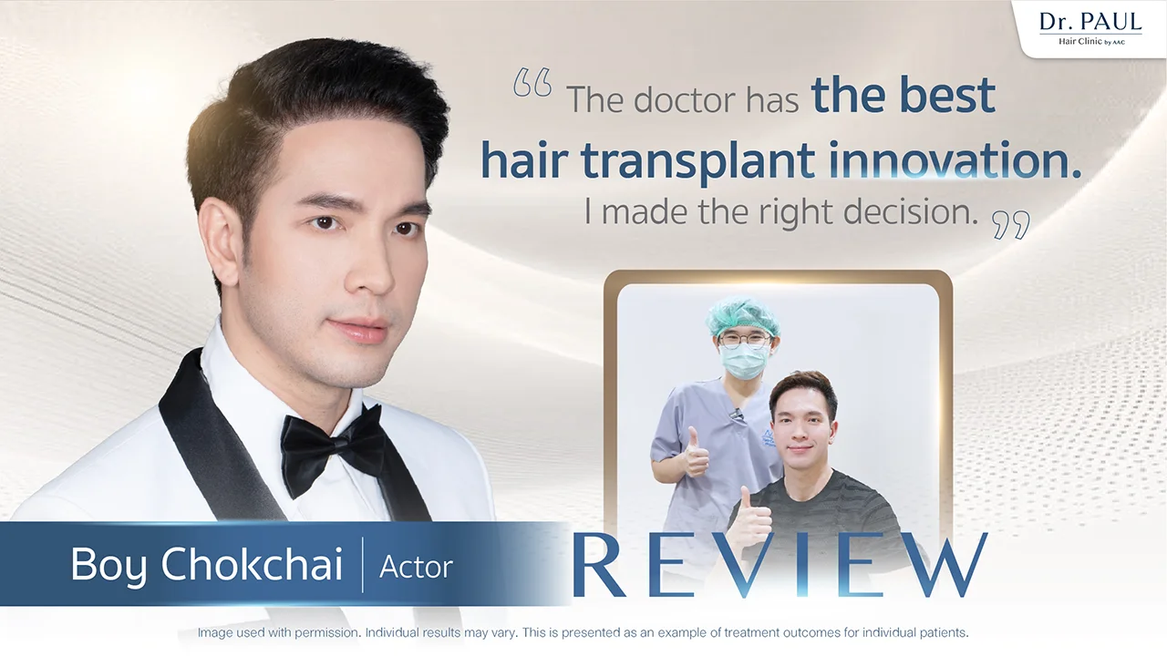 Thai Male Celebs Hair Transplant Review — Boy Chokchai