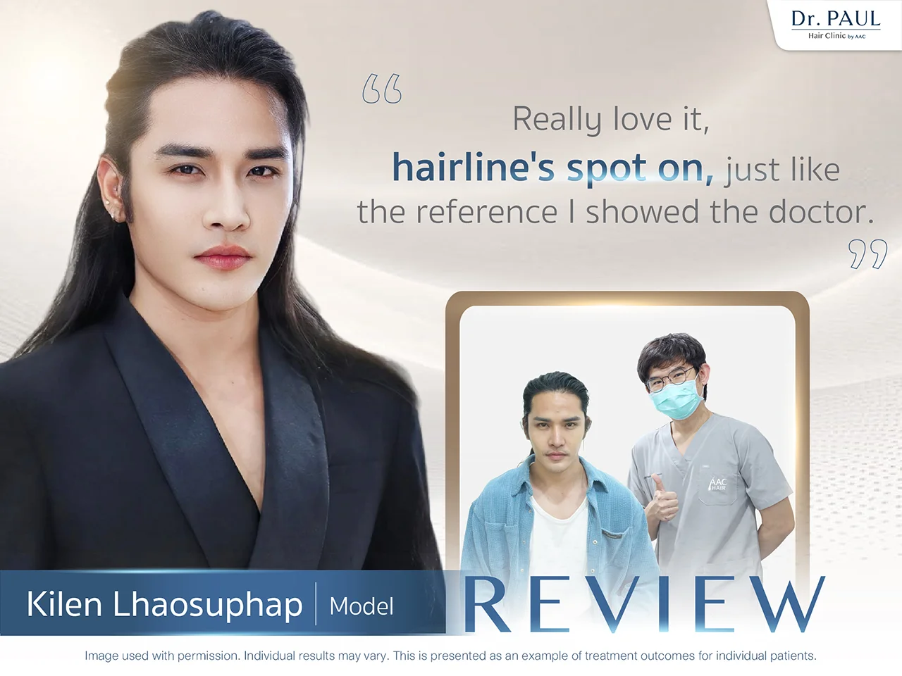 Thai Male Celebs Hair Transplant Review — Kilen Lhaosuphap