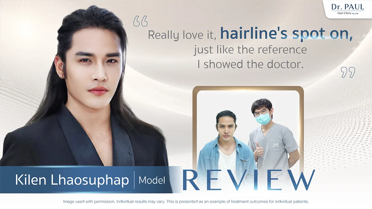 Thai Male Celebs Hair Transplant Review — Kilen Lhaosuphap