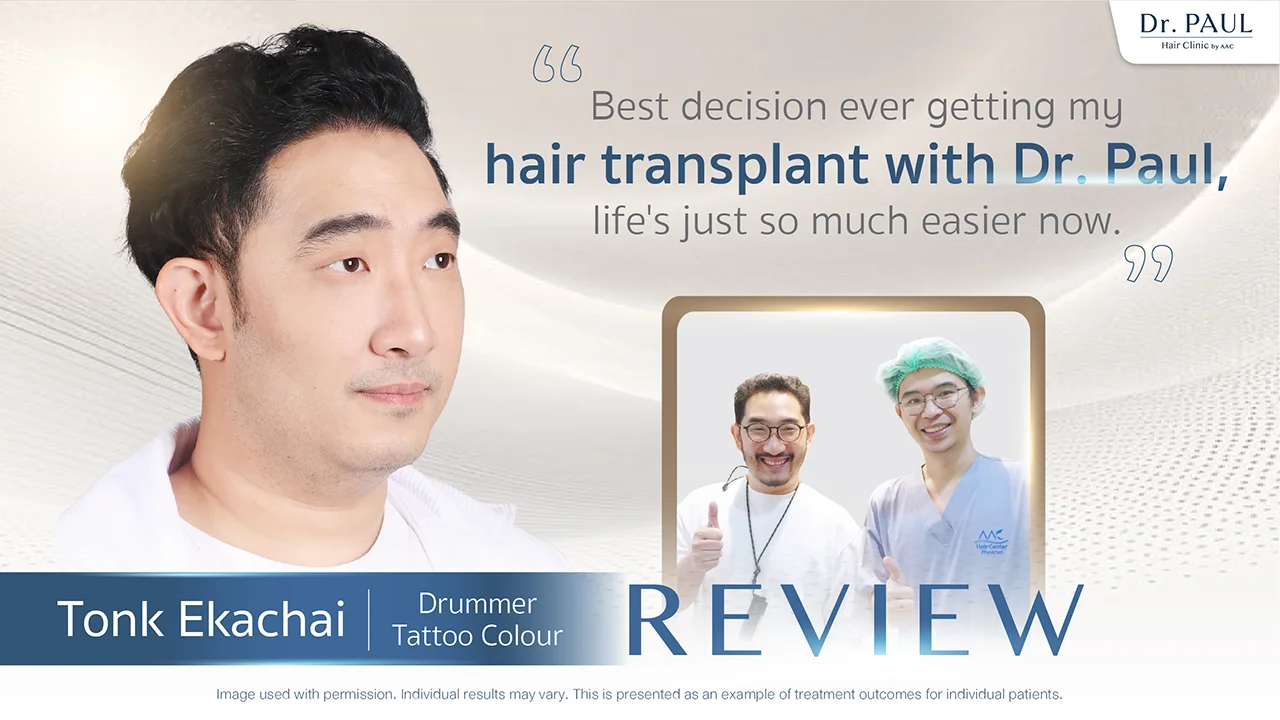 Thai Male Celebs Hair Transplant Review — Tonk Tattoo Colour