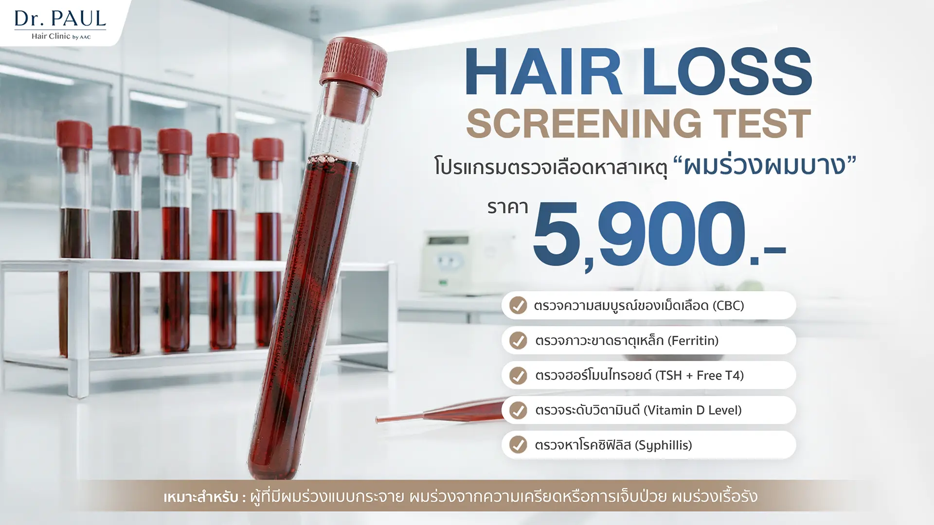 โปรแกรมตรวจเลือดหาสาเหตุผมร่วง สำหรับการคัดกรองทั่วไป
