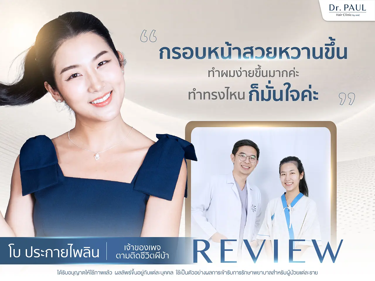 รีวิวปลูกผมผู้หญิง โบ ประกายไฟลิน