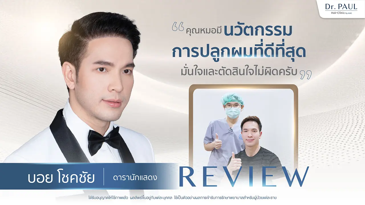 รีวิวปลูกผม บอย โชคชัย ดารานักแสดงชาย