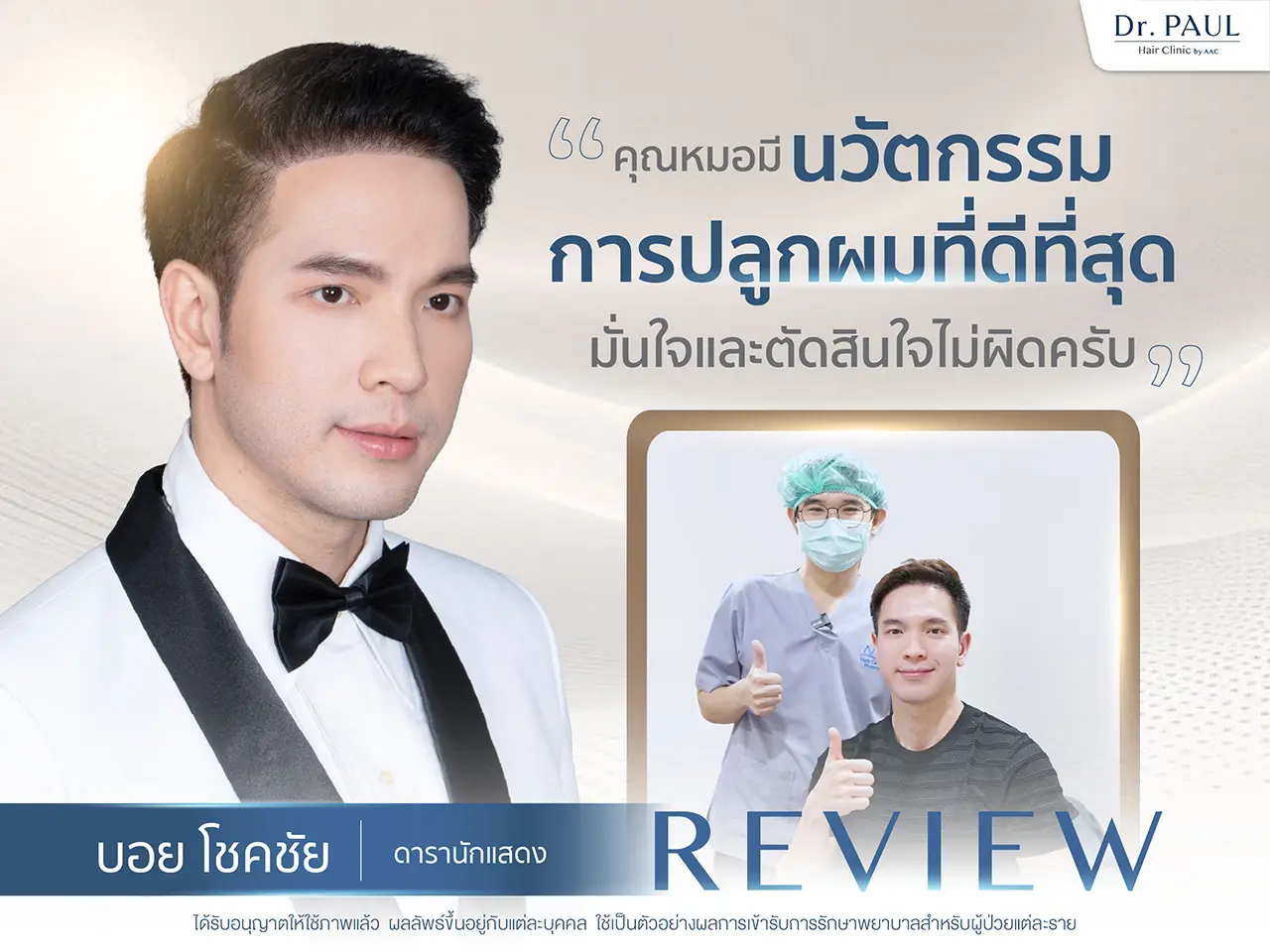 รีวิวปลูกผม บอย โชคชัย ดารานักแสดงชาย