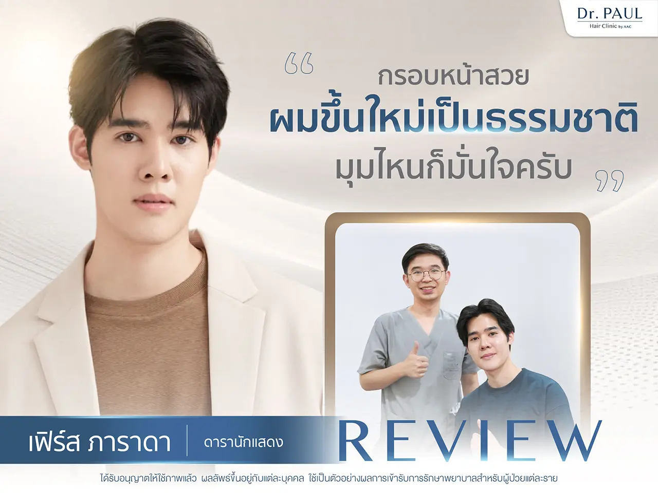 รีวิวปลูกผม เฟิร์ส ภาราดา ดารานักแสดงชาย