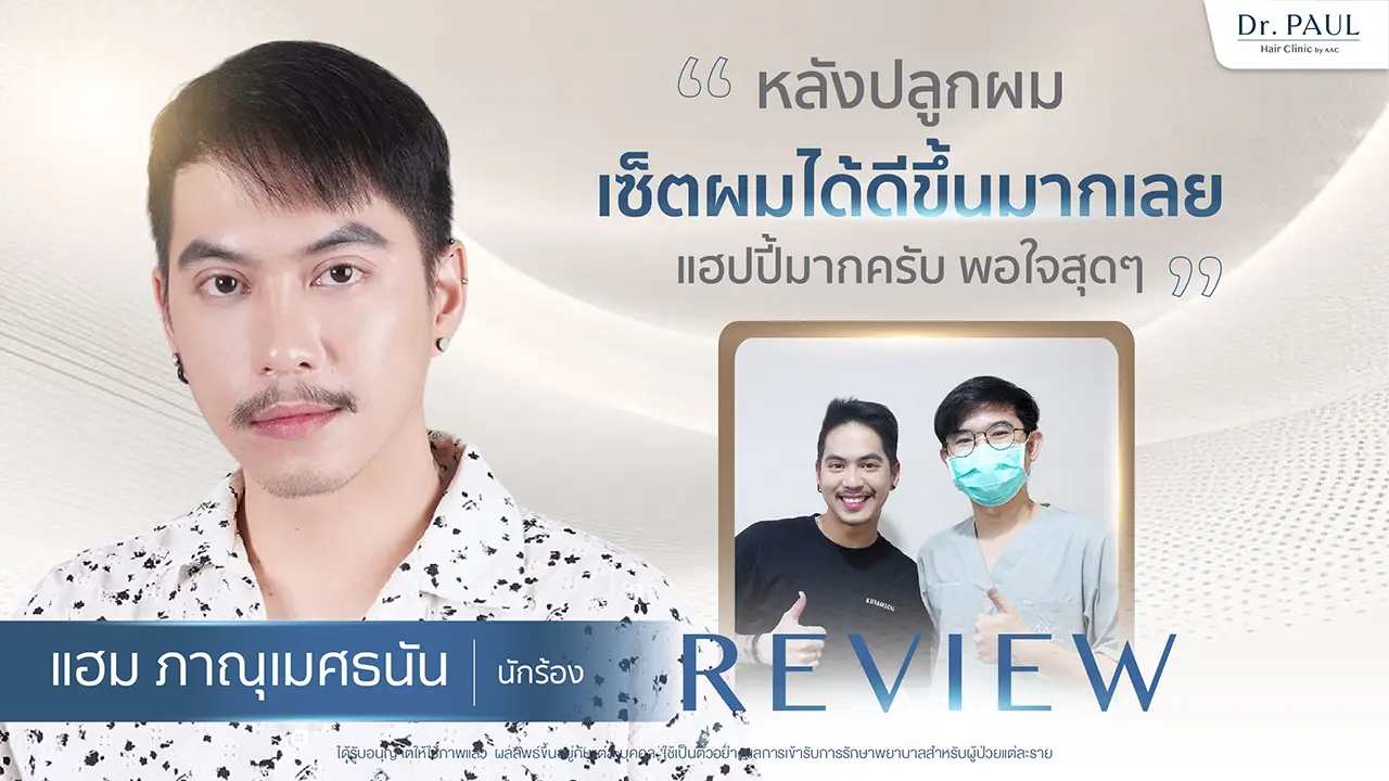 รีวิวปลูกผม แฮม PMN ภาณุเมศธนัน นักร้องชาย