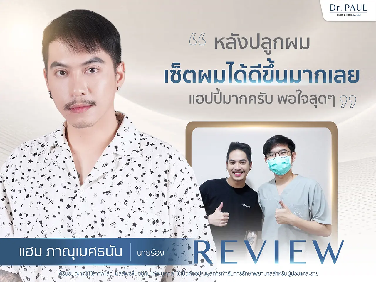 รีวิวปลูกผม แฮม PMN ภาณุเมศธนัน นักร้องชาย