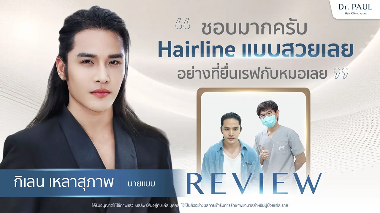 รีวิวปลูกผม กิเลน เหลาสุภาพ นายแบบ