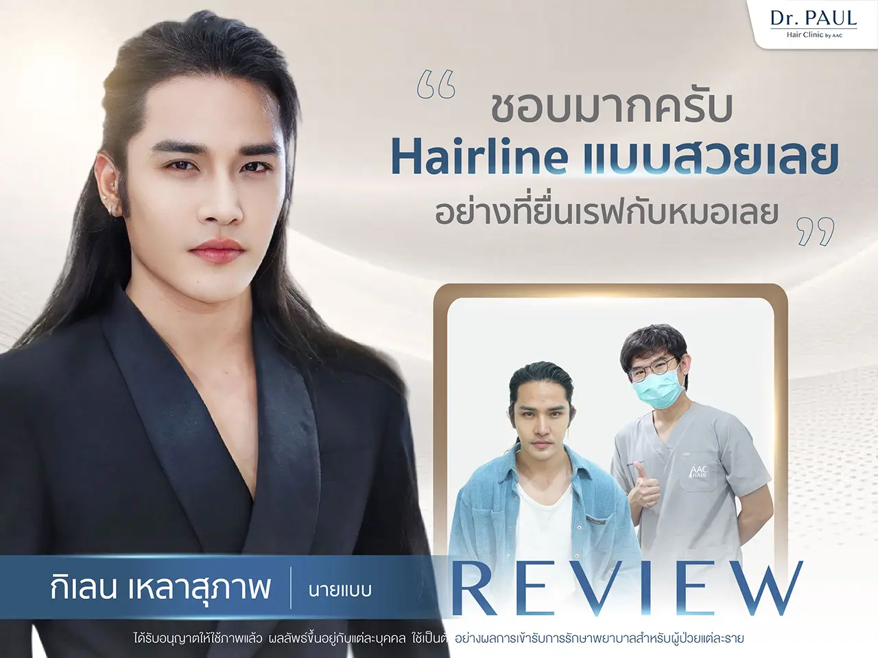 รีวิวปลูกผม กิเลน เหลาสุภาพ นายแบบ