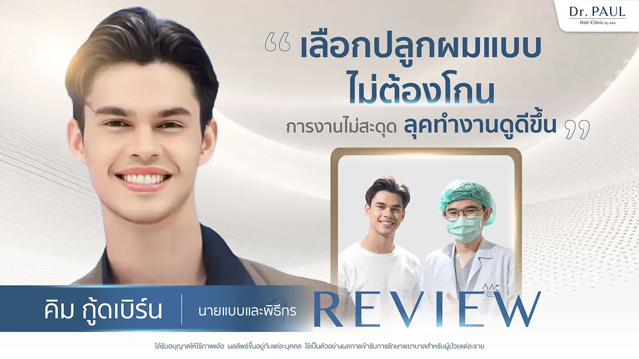 รีวิวปลูกผม คิม กู้ดเบิร์ด The Face Men