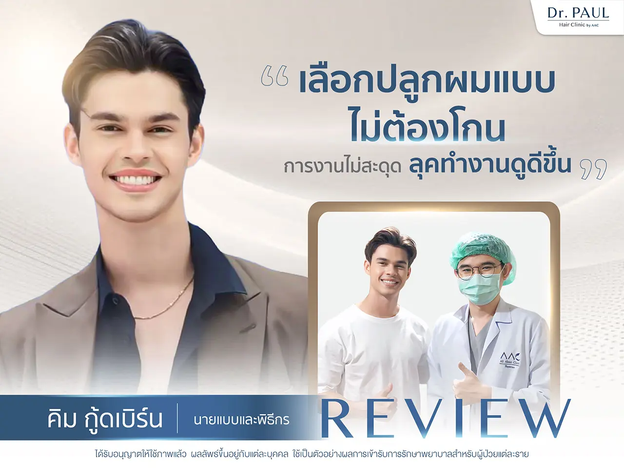 รีวิวปลูกผม คิม กู้ดเบิร์ด The Face Men