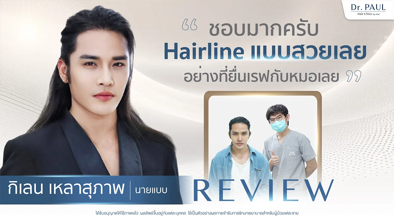 รีวิวปลูกผม กิเลน เหลาสุภาพ นายแบบ