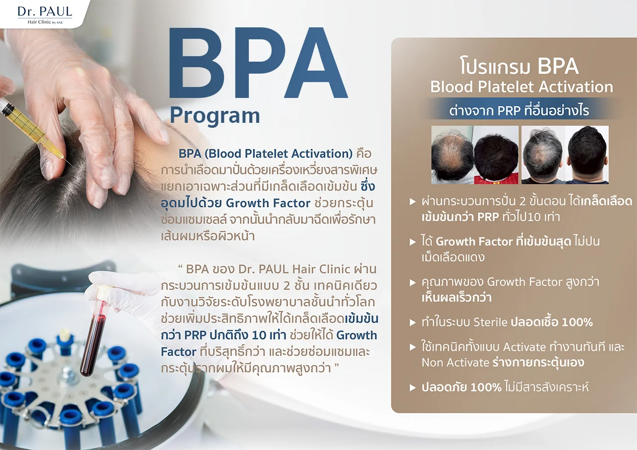 โปรแกรม Blood Platelet Activation (BPA) คืออะไร ต่างจาก PRP อย่างไร