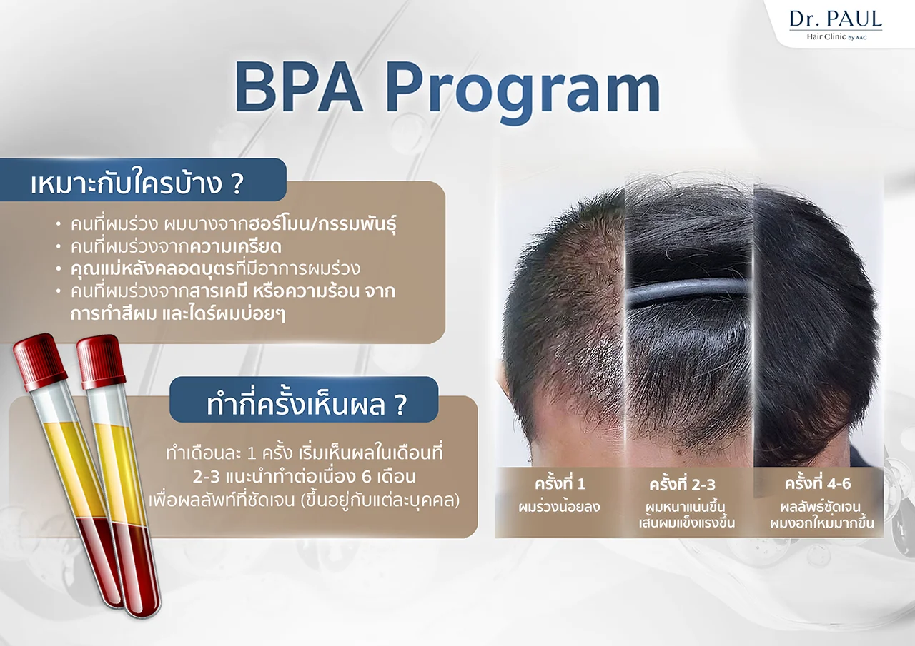 BPA บำรุงผม เหมาะกับใครบ้าง ทำกี่ครั้งเห็นผล